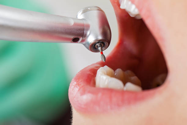 Best Emergency Dental Surgery in The Village, OK